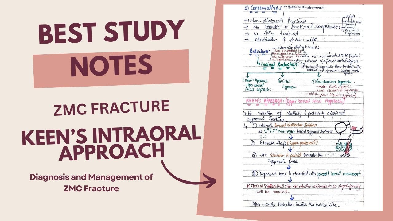 Keen's Intraoral Approach I ZMC Fracture I Diagnosis I Treatment I Oral and Maxillofacial Surgery