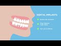 Are Dental Implants a Long term Solution?