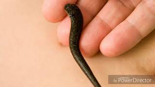 Sibir tabiblarining bavosirni davolash usullari HD