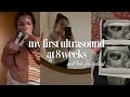 8 Week Ultrasound Appointment + How I&#39;m Feeling! | Bianca Marie