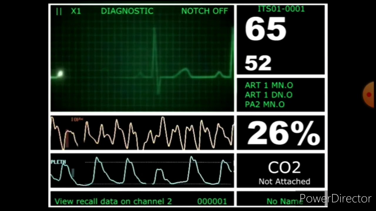 hospital monitor with flatline life to death YouTube