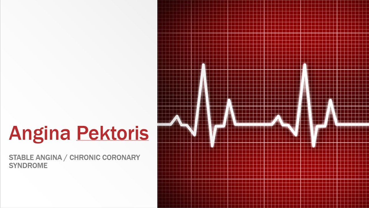 Angina Pektoris Stabil / stable angina / chronic coronary syndrome