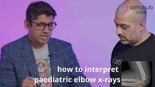 orthohub ODM: how to interpret paediatric elbow x-rays with Anish Sanghrajka – orthopaedic surgeons