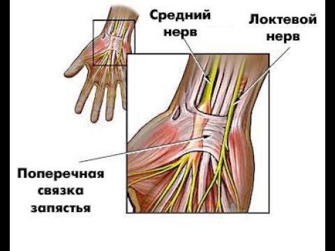 Туннельная нейропатия. Туннельный синдром локтевого нерва. Срединный нерв в области лучезапястного сустава. Анатомия локтевого нерва в лучезапястном суставе. Анатомия срединного нерва в карпальном канале.