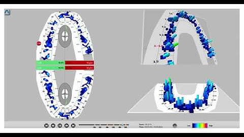 T-Scan Novus Introduction