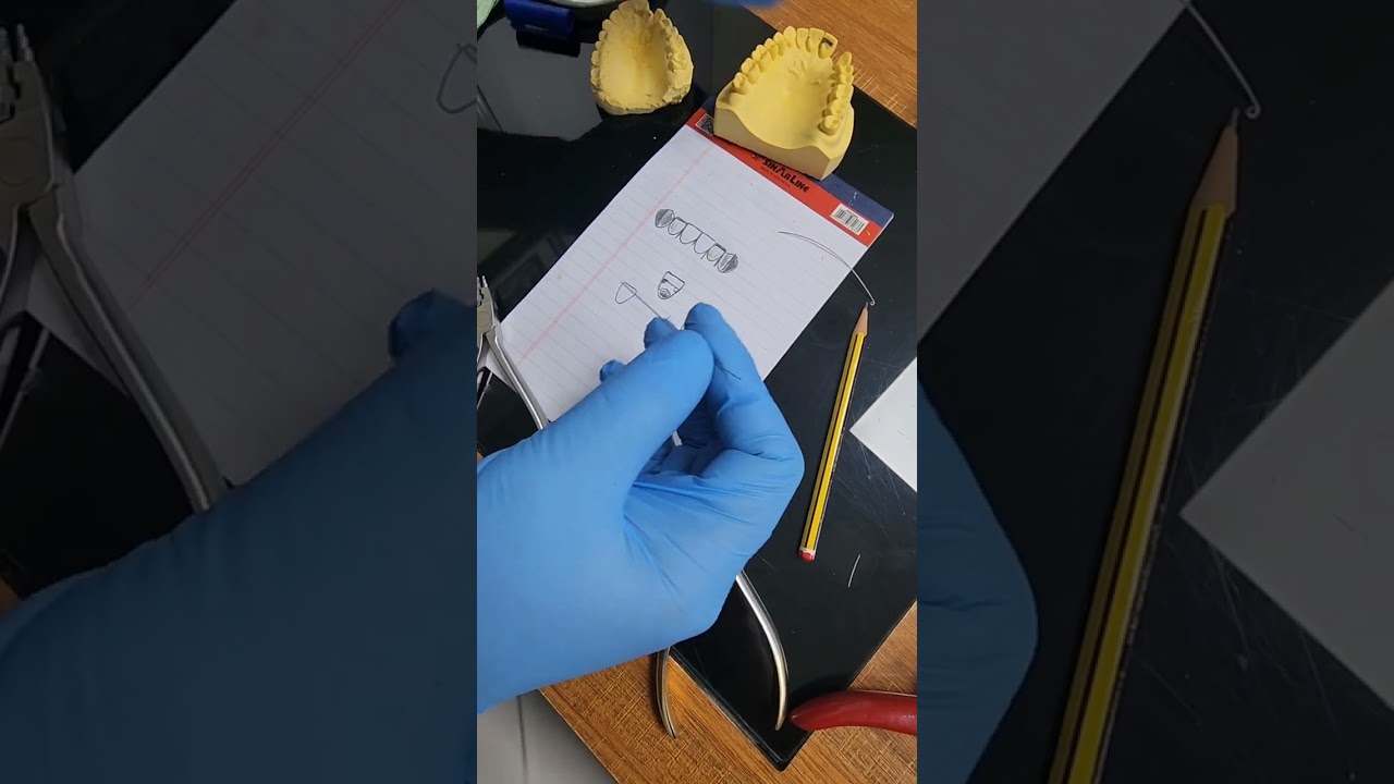 تقويم الأسنان كيفية عمل Z spring