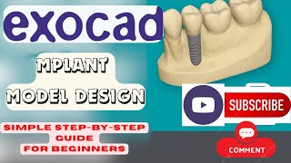 Exocad Implant Model Design | Simple Step-by-Step Guide for Beginners