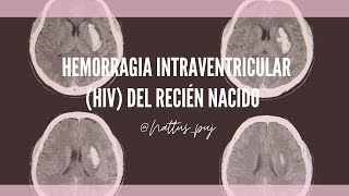 Hemorragia intraventricular del recién nacido.