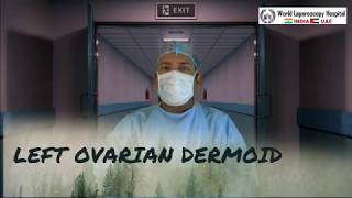 Ooforoplastia por video (cisto dermoide) / Video oophoroplasty (dermoid  cyst) 