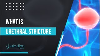 What Is Urethral Stricture?