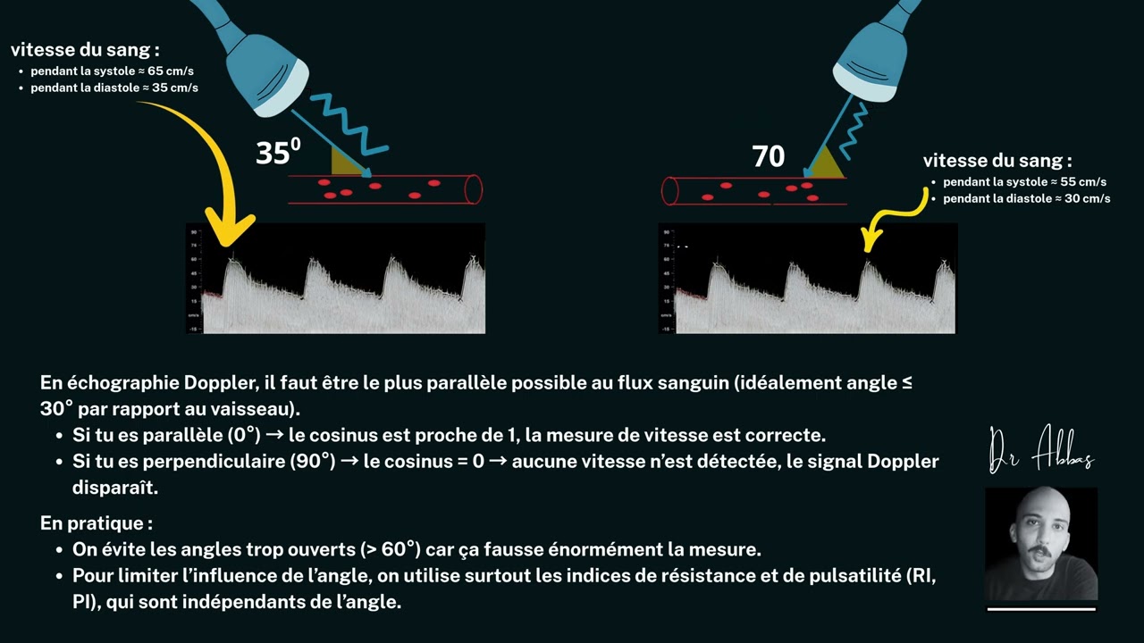 L'échographie doppler en obstétrique : épisode 01 - Introduction