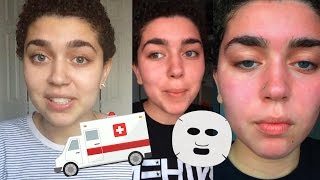 MY EXTREME ALLERGIC REACTION TO A FACE MASK: STORYTIME