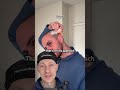 7 Months Of Hair Growth Post Hair Transplant