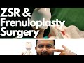 Frenuloplasty and ZSR Circumcision by Dr.Sachin Kuber +919370275336/+919370240098