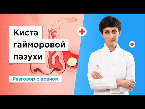 Лечение кисты гайморовой пазухи в Москве бесплатно по полису ОМС