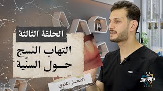 الحلقة الثالثة: التهاب النسج حول السنّية (الموسم الثالث)