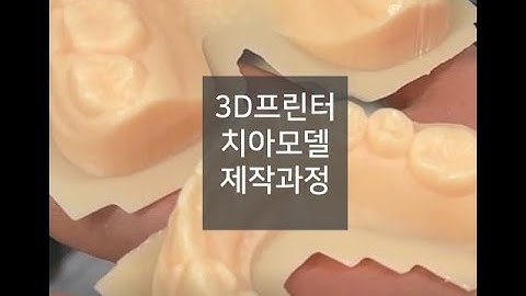 🦷3D프린터로 치아모델 제작과정🦷