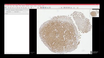 How can I load my virtual slides from the cloud into Qupath?