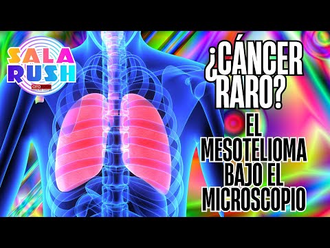 ¿Cáncer Raro? El