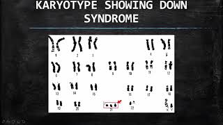 LIFE SCIENCES: MEIOSIS PART 2 GRADE 12