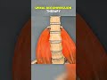 Spinal Decompression Therapy|3D ANIMATIONS| #SpinalDecompression#SpinalDecompressionTherapy#fyp