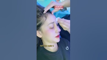 Nâng Mũi bao lâu thì tháo nẹp ! #bacsikim #pttm