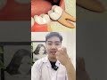 Nguy Hiểm! Nguy cơ Lệch mặt khi nhổ răng khôn #răng #nhakhoa