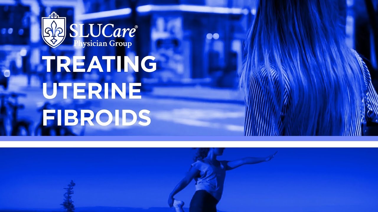 Treat Uterine Fibroids with Minimally Invasive Gynecological Surgery - SLUCare OB/GYN - YouTube