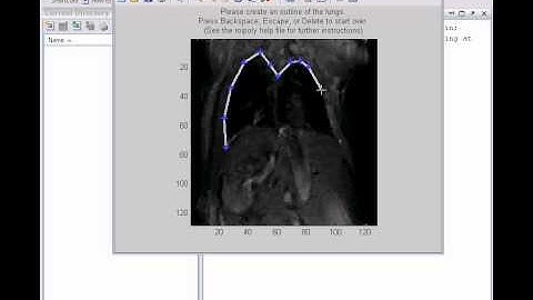 Running the Matlab Lung_Segmenation_Main.m program