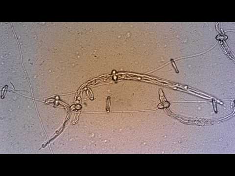 Nematophagous fungi: Predator fungi