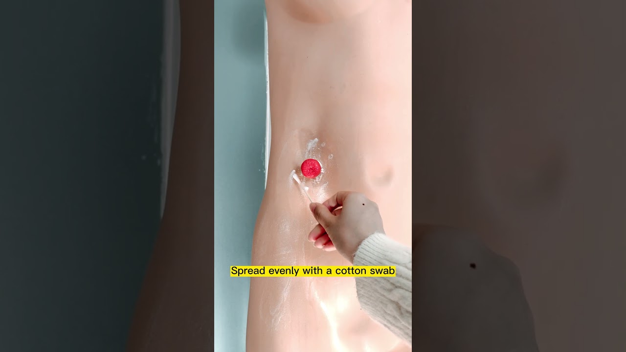 Dry skin, how to stick the ostomy bag correctly？