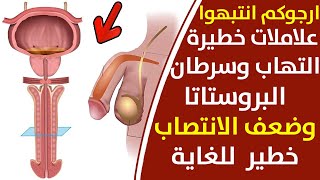 علامات خطيرة على التهاب البروستاتا وانواع البروستات وطريقة زيادة الباءة وافضل علاج لتضخم البروستاتا