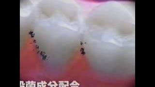 薬用LISTERINE CM(2001)