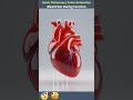 Pulmonary Valve