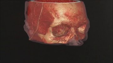 AR Vizua platform and Microsoft Hololens without Time Wrap - Brain