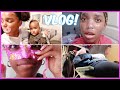 VLOG: I GOT MY TOOTH PULLED, BIRTHDAY PARTY, HALLOWEEN, HOME ALONE SELF CARE &amp; MORE | YOSHIDOLL