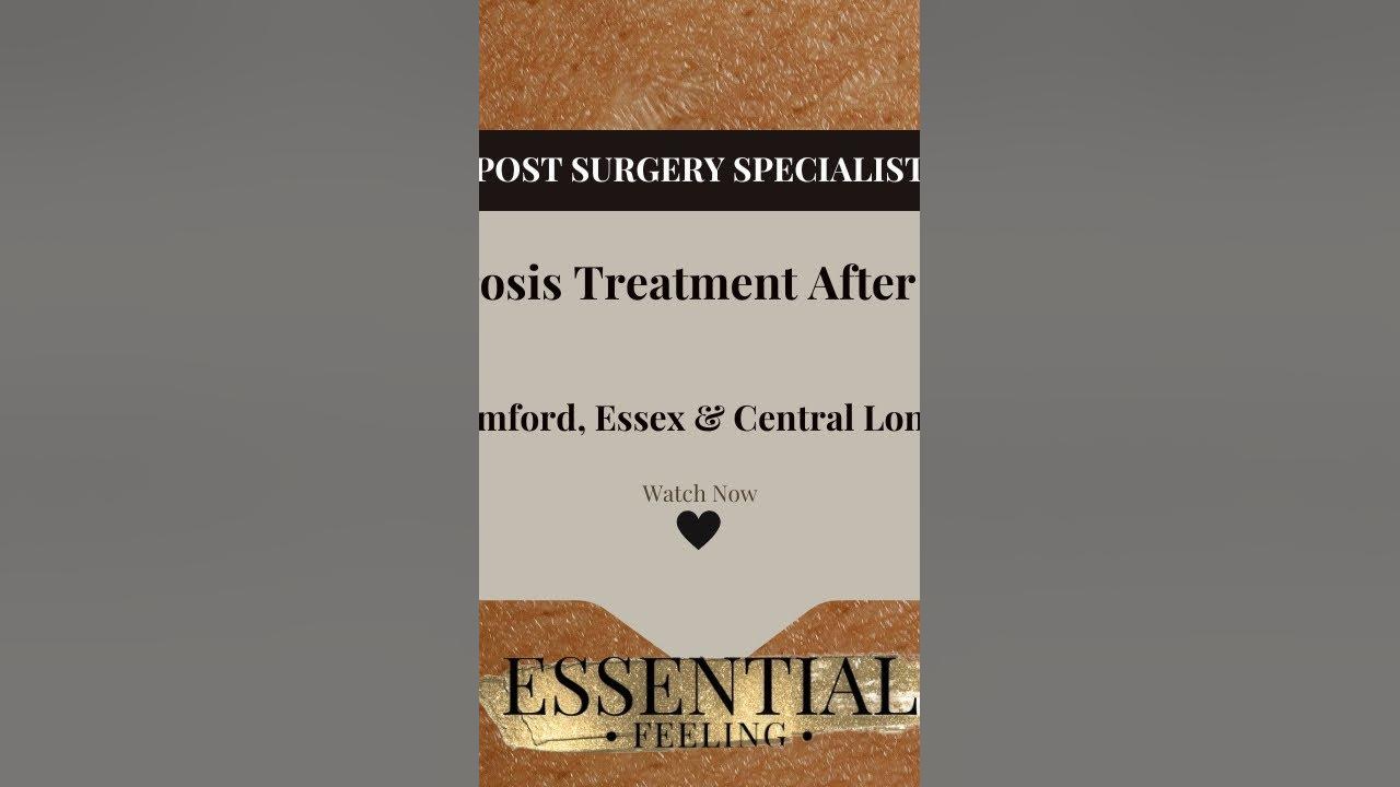lumps-after-lipo-lumpy-liposuction-lumpy-stomach-after-liposuction
