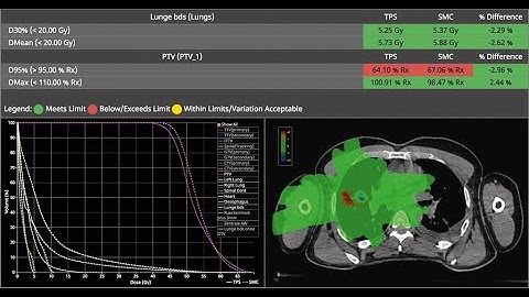 Monte Carlo Patient QA - SciMoCa Software Demo