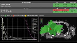 Monte Carlo Patient QA - SciMoCa Software Demo screenshot 2