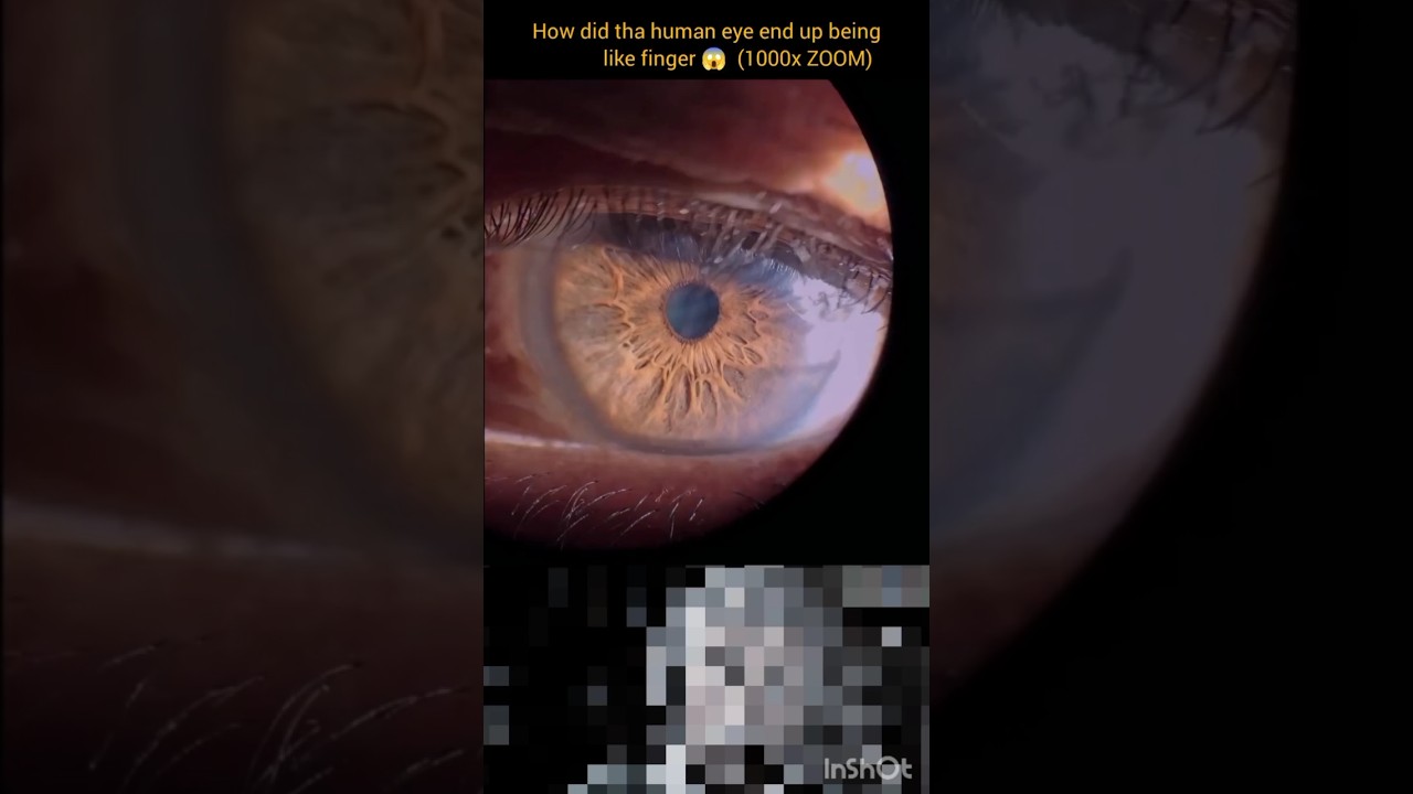 Shocking  Zoom! Our Eye looks like a finger ?!😱😱💀 1000x Microscope 