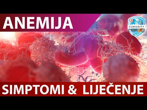 Znakovi i simptomi anemije s nedostatkom željeza Dr#74