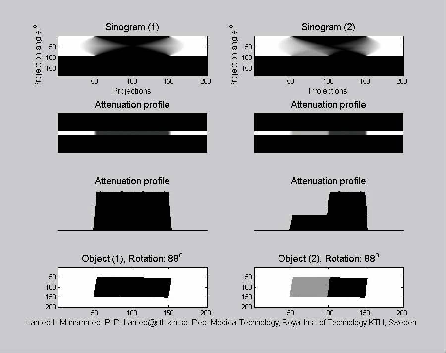 CT Animation - Computed Tomography: How to generate sinograms in a CT ...