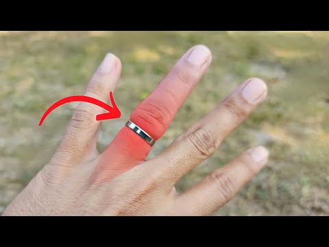 Video: 3 Cara Memotong Cincin