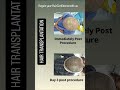 Hair Transplant Surgery