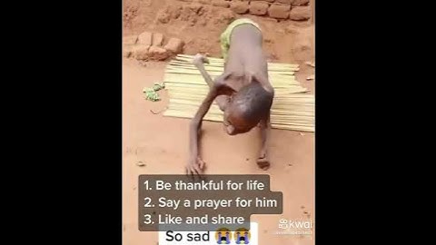 a fome na ÁFRICA mata miliois de pessoas  orem pelos irmãos da ÁFRICA