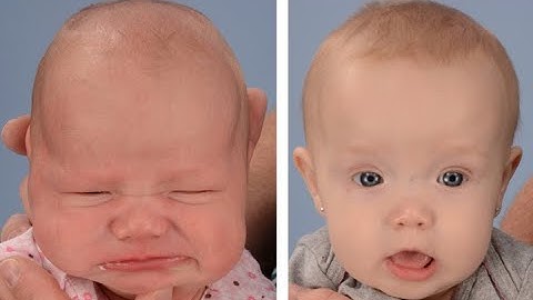 Craniectomy suboccipital CPT code - simplify medical coding