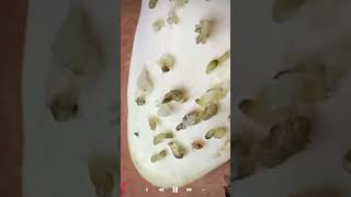Skincare Blackheads Removal Skincare Blackheads