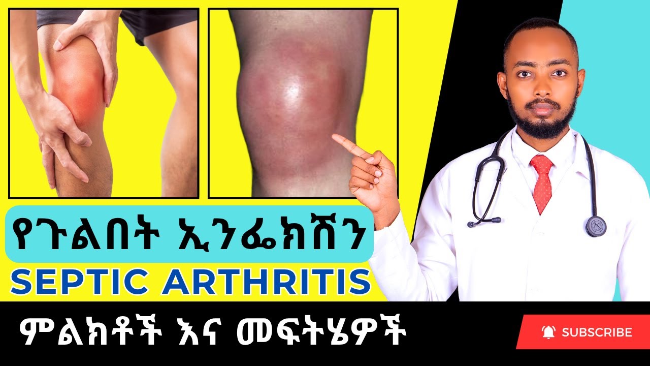 Ethiopia | የጉልበት ኢንፌክሽን በሽታ ምልክቶች እና መፍትሄዎች