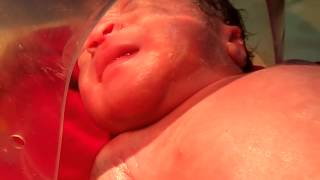 Medical Education Video: Neonatology: Grunt- Respiratory distress in newborn Infant Grunting Respiratory Distress Medical Overview