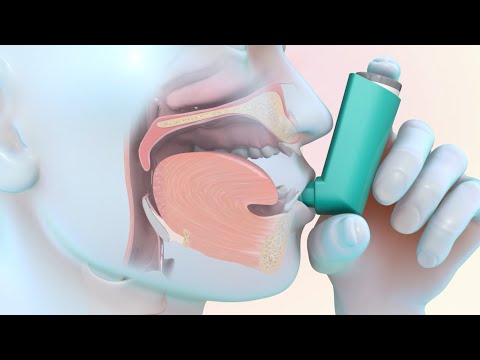 Video: ¿Cuándo se debe usar salbutamol?